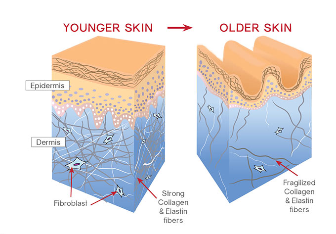 Aging Skin